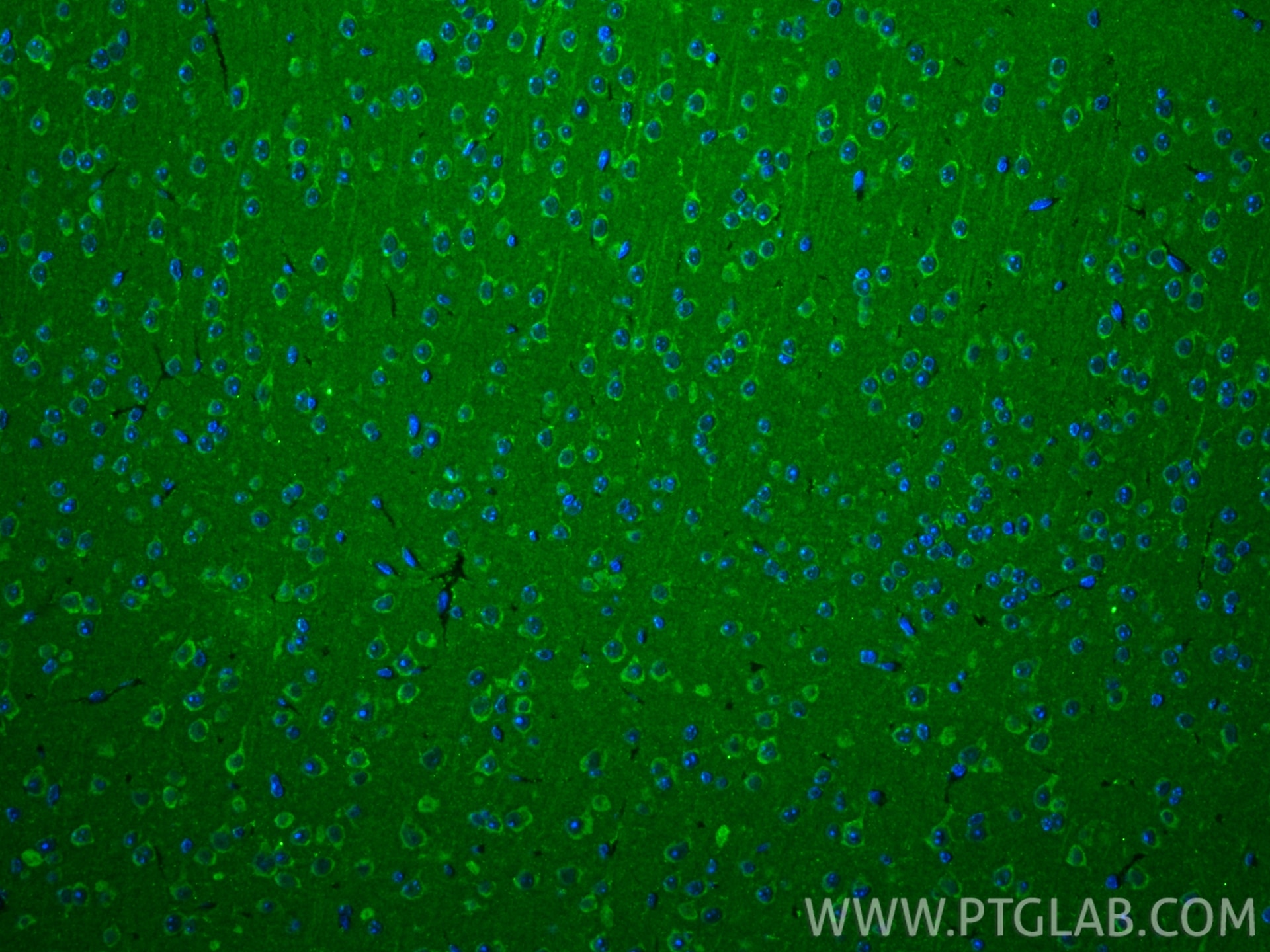 Immunofluorescence (IF) / fluorescent staining of mouse brain tissue using RNASEH1 Recombinant monoclonal antibody (82771-1-RR)