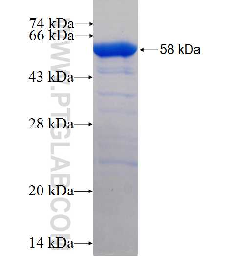 RNASEH1 fusion protein Ag7990 SDS-PAGE