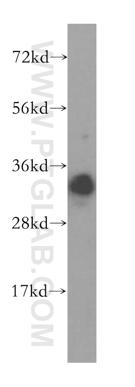 WB analysis of human liver using 16132-1-AP