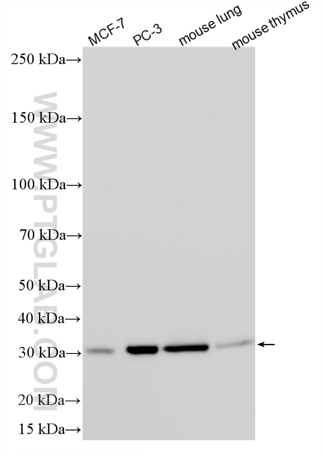 Western Blot (WB) analysis of various lysates using RNASEH2B Polyclonal antibody (17527-1-AP)