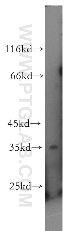Western Blot (WB) analysis of HeLa cells using RNASEH2B Polyclonal antibody (17527-1-AP)