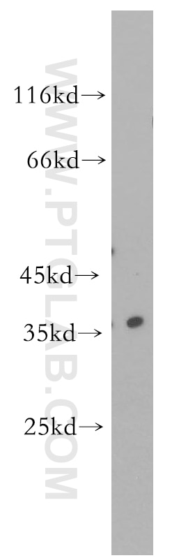 Western Blot (WB) analysis of MCF-7 cells using RNASEH2B Polyclonal antibody (17527-1-AP)