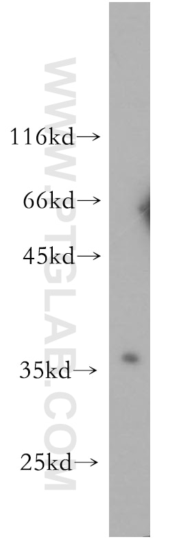 Western Blot (WB) analysis of mouse lung tissue using RNASEH2B Polyclonal antibody (17527-1-AP)