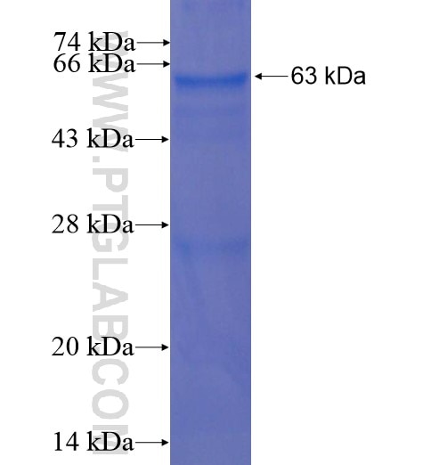 RNASEH2B fusion protein Ag11189 SDS-PAGE