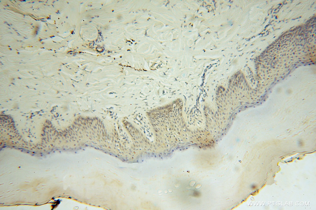 Immunohistochemistry (IHC) staining of human skin tissue using RNASEH2C Polyclonal antibody (16518-1-AP)