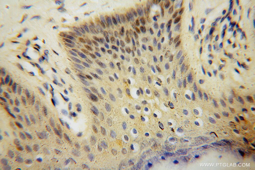 Immunohistochemistry (IHC) staining of human skin tissue using RNASEH2C Polyclonal antibody (16518-1-AP)