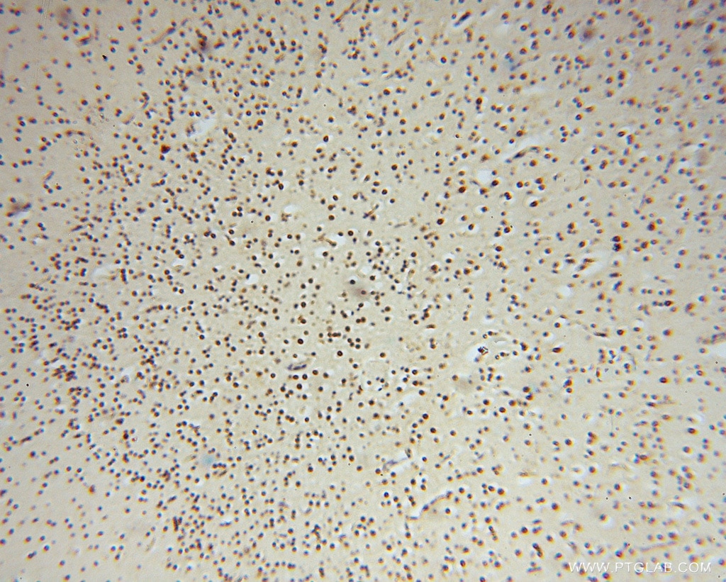 Immunohistochemistry (IHC) staining of human brain tissue using RNASEH2C Polyclonal antibody (16518-1-AP)