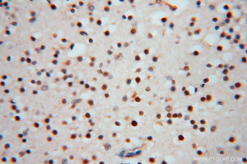 Immunohistochemistry (IHC) staining of human brain tissue using RNASEH2C Polyclonal antibody (16518-1-AP)