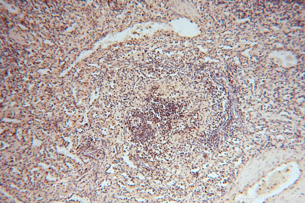 Immunohistochemistry (IHC) staining of human spleen tissue using RNASEH2C Polyclonal antibody (16518-1-AP)