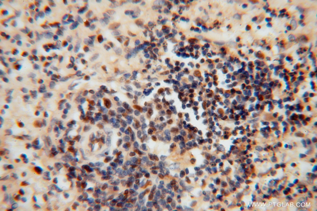 Immunohistochemistry (IHC) staining of human spleen tissue using RNASEH2C Polyclonal antibody (16518-1-AP)