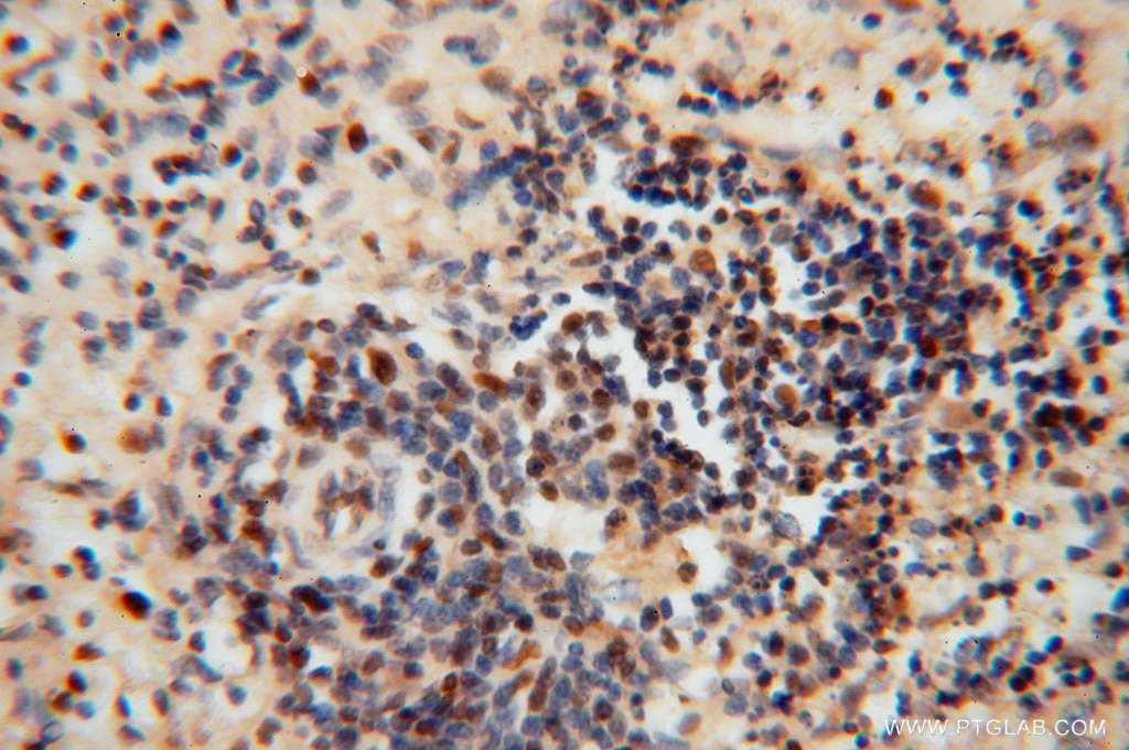 IHC staining of human spleen using 16518-1-AP