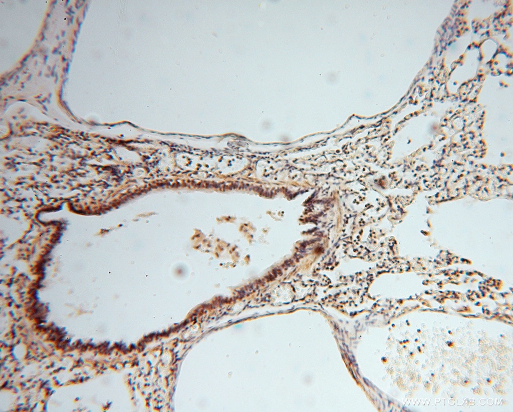 IHC staining of human lung using 16518-1-AP