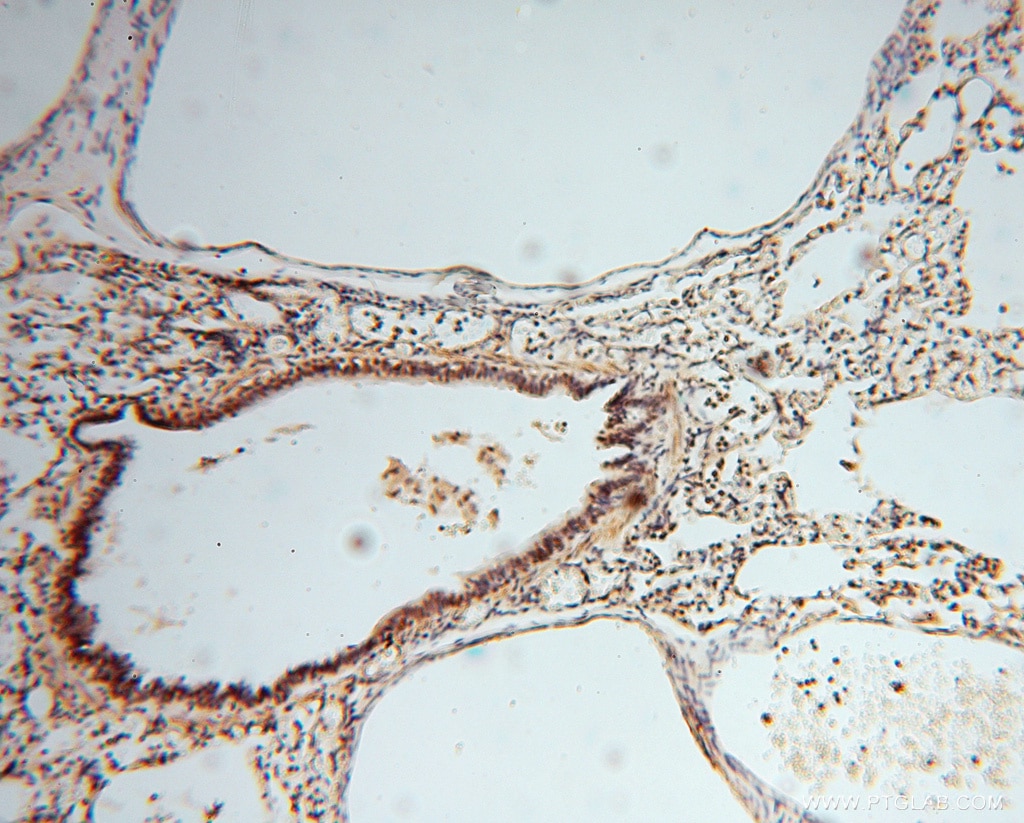 Immunohistochemistry (IHC) staining of human lung tissue using RNASEH2C Polyclonal antibody (16518-1-AP)