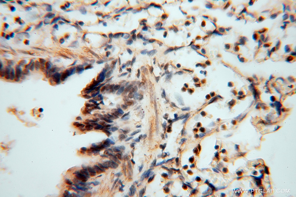 IHC staining of human lung using 16518-1-AP
