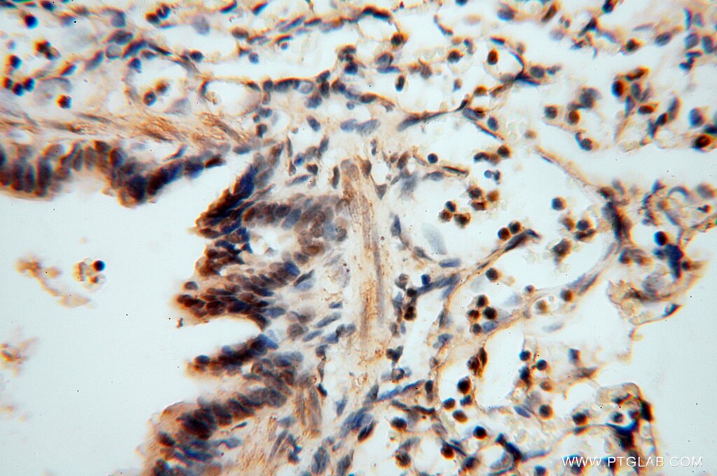 Immunohistochemistry (IHC) staining of human lung tissue using RNASEH2C Polyclonal antibody (16518-1-AP)