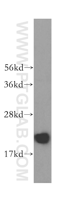 Western Blot (WB) analysis of HEK-293 cells using RNASEH2C Polyclonal antibody (16518-1-AP)
