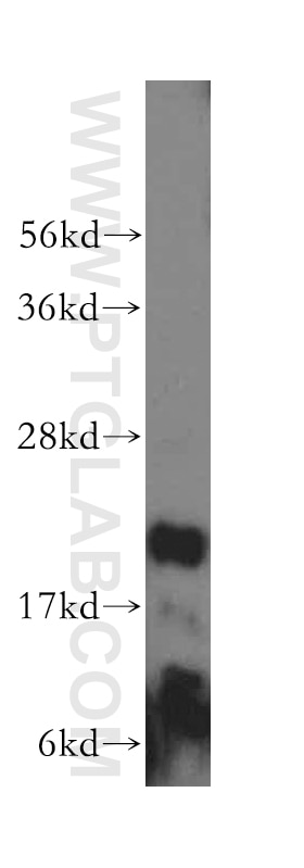 Western Blot (WB) analysis of human spleen tissue using RNASEH2C Polyclonal antibody (16518-1-AP)