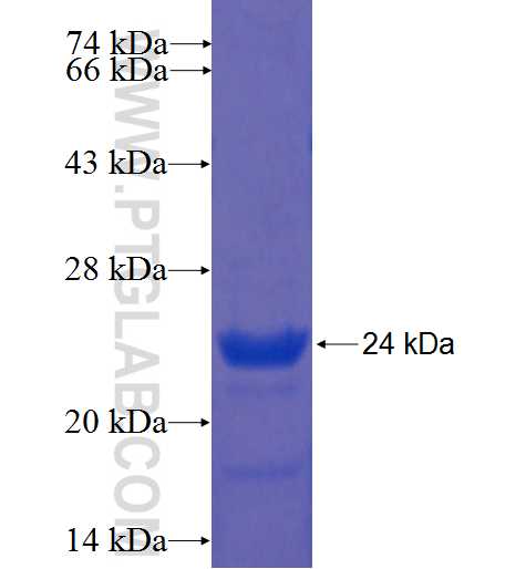 RNASEH2C fusion protein Ag9723 SDS-PAGE
