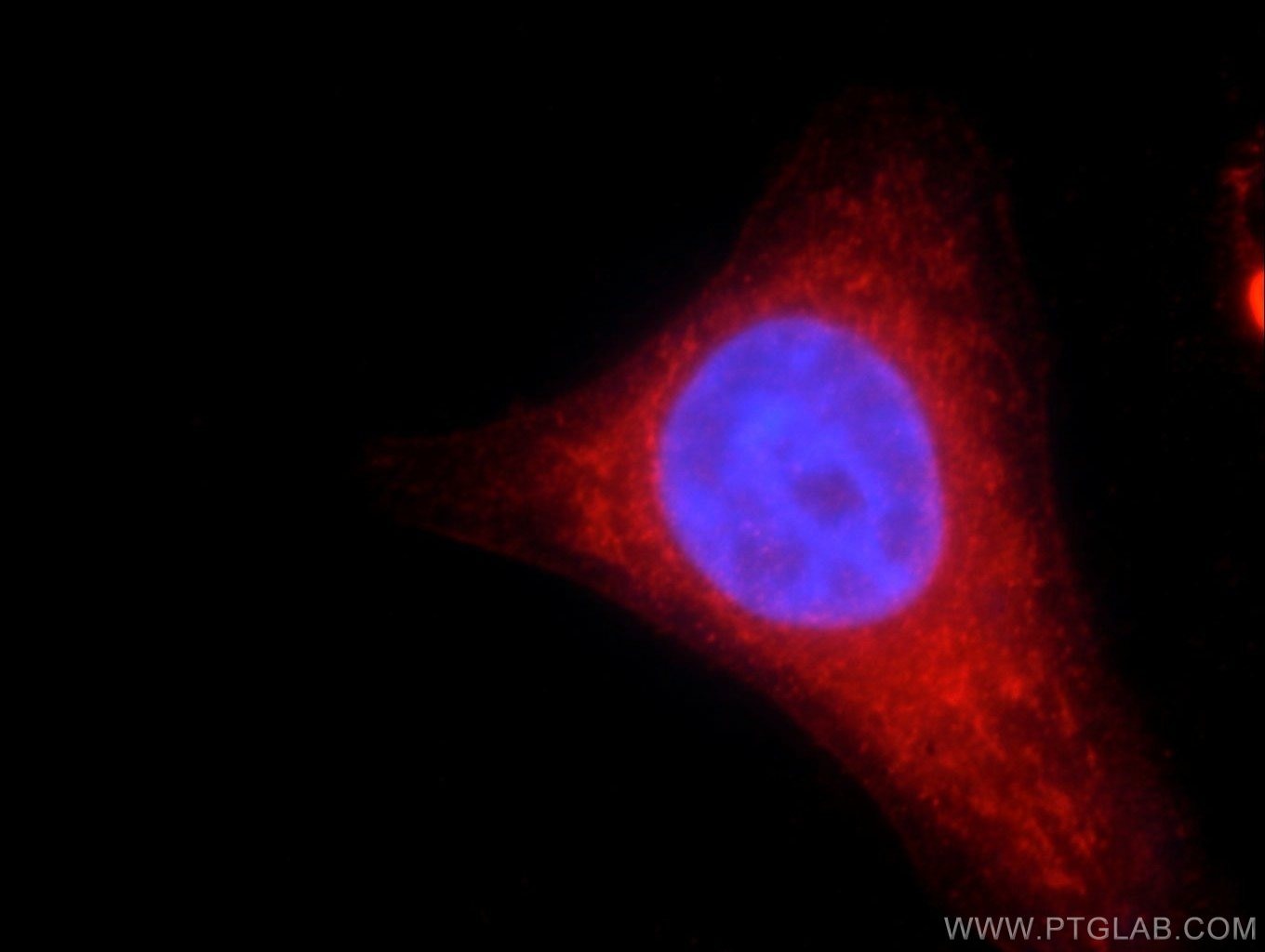 Immunofluorescence (IF) / fluorescent staining of HepG2 cells using RNASEL Polyclonal antibody (22577-1-AP)