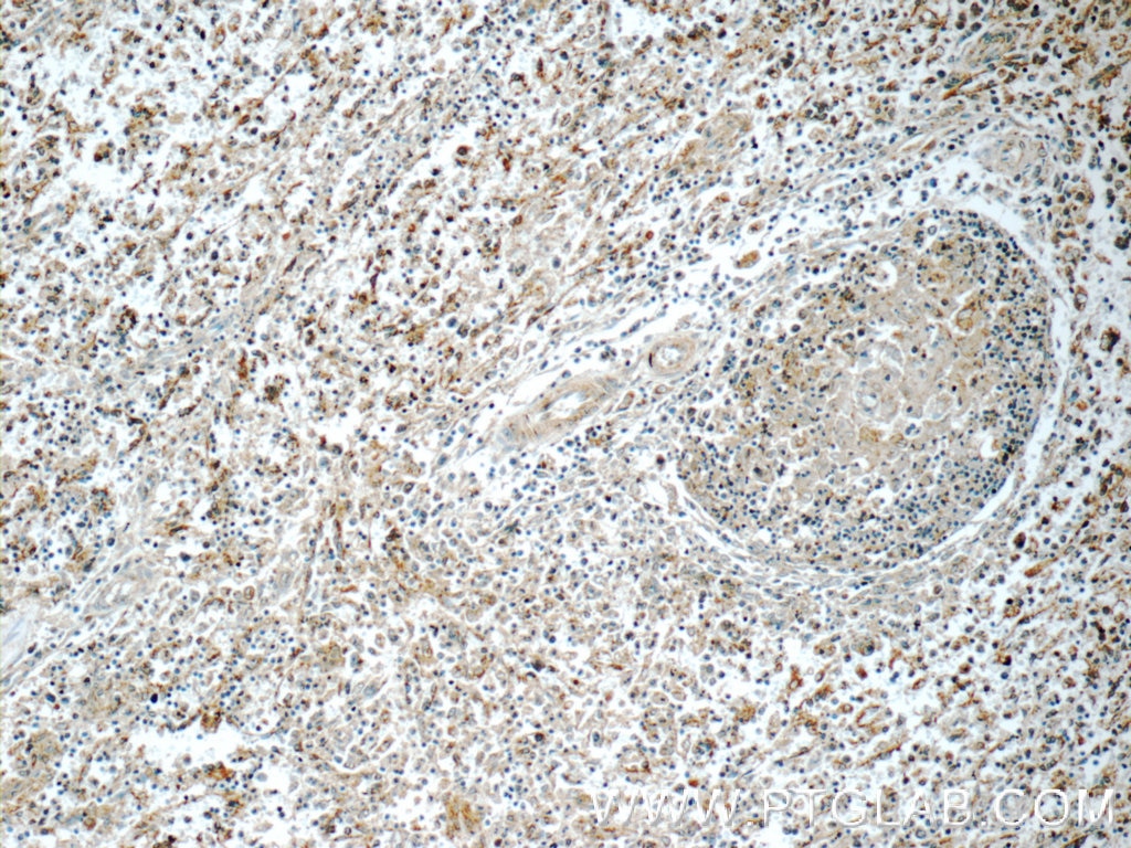 Immunohistochemistry (IHC) staining of human spleen tissue using RNASEL Polyclonal antibody (22577-1-AP)