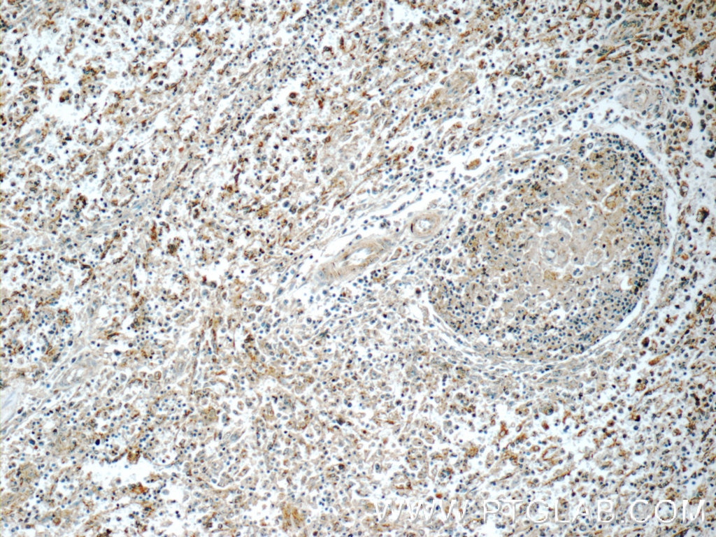 IHC staining of human spleen using 22577-1-AP