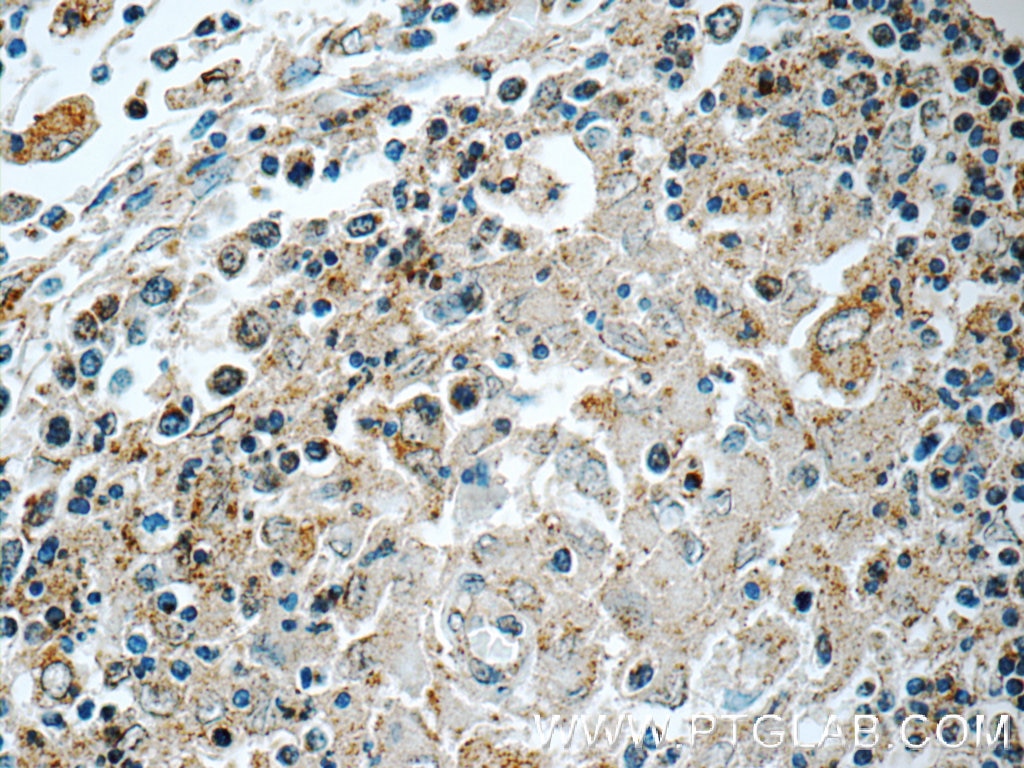 IHC staining of human spleen using 22577-1-AP