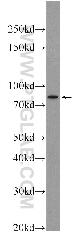 Western Blot (WB) analysis of RAW 264.7 cells using RNASEL Polyclonal antibody (22577-1-AP)