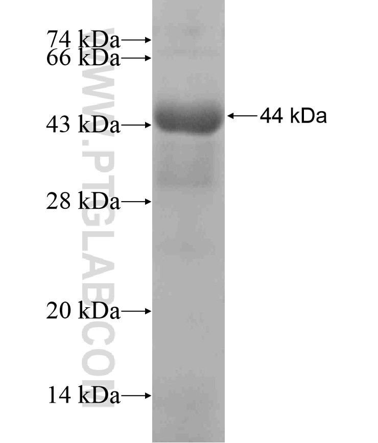 RNASEL fusion protein Ag17409 SDS-PAGE