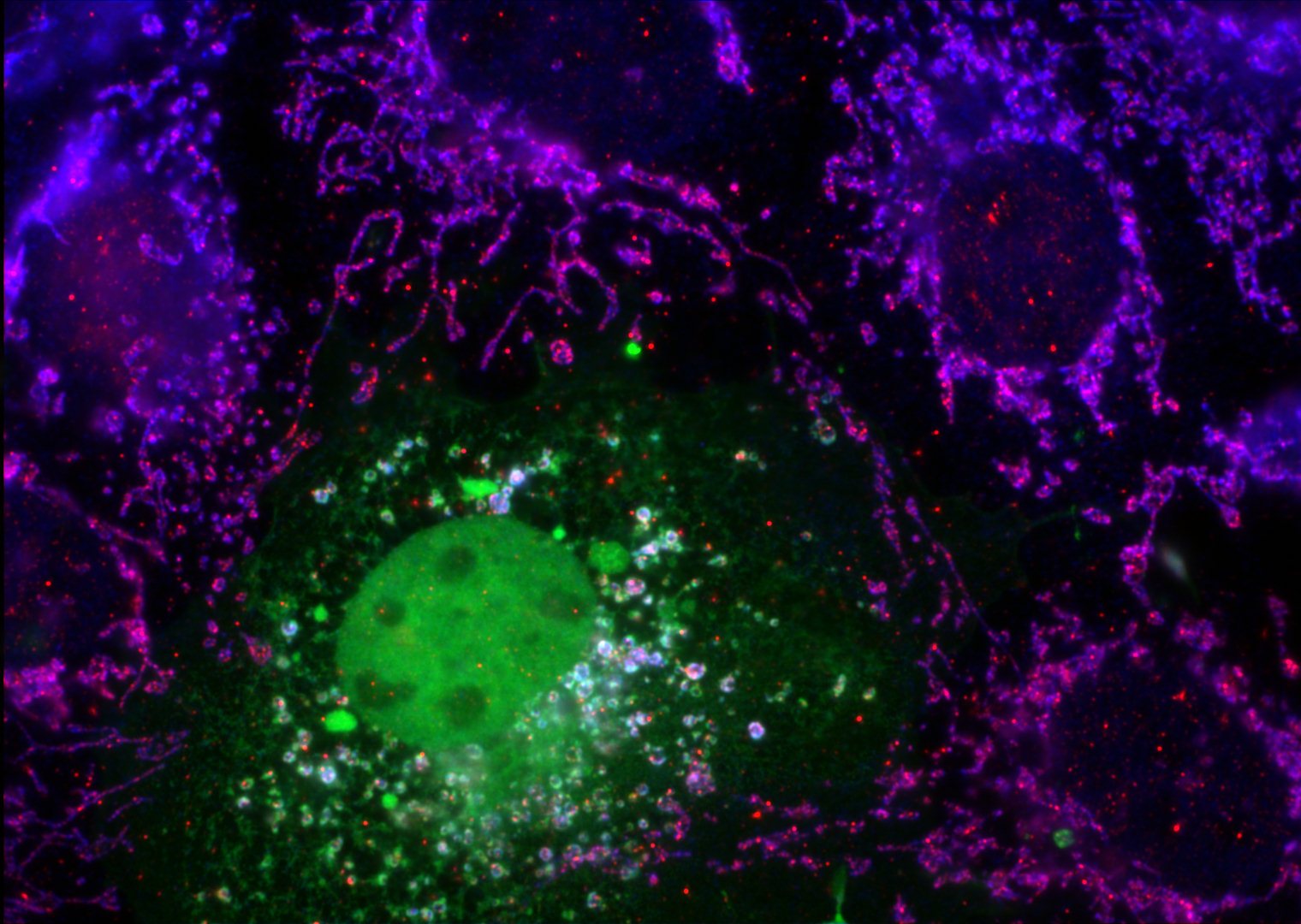 Immunofluorescence (IF) / fluorescent staining of transfected cells using RNase T2 Polyclonal antibody (13753-1-AP)