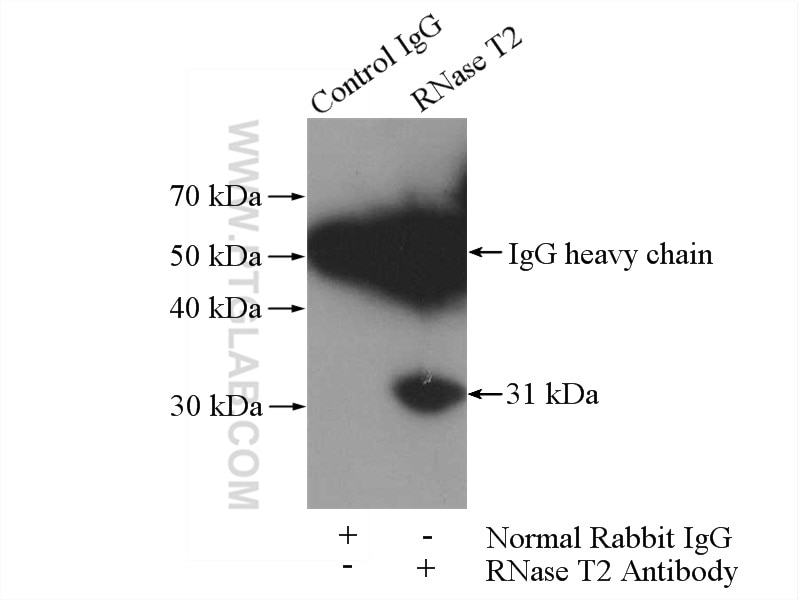 Immunoprecipitation (IP) experiment of BxPC-3 cells using RNase T2 Polyclonal antibody (13753-1-AP)