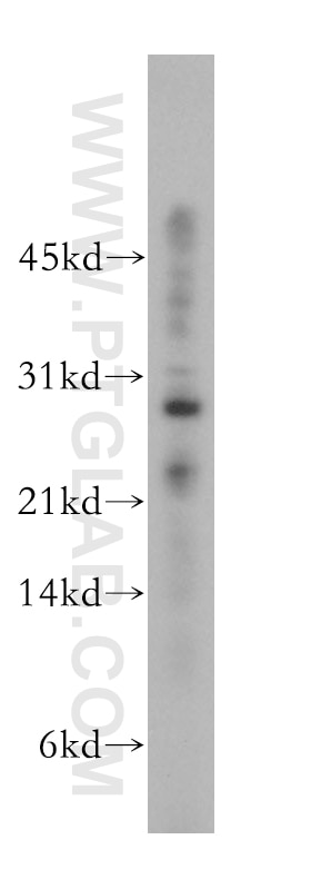 RNase T2