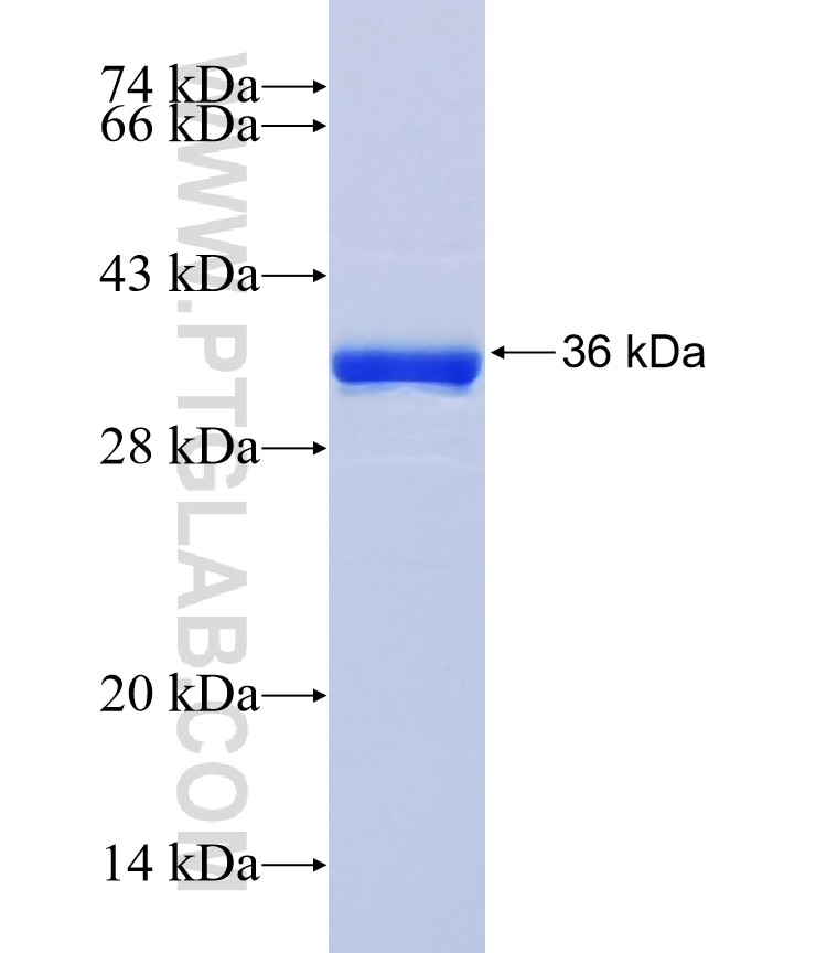 RNASET2 fusion protein Ag36600 SDS-PAGE RNASET2 fusion protein Ag36600 SDS-PAGE
