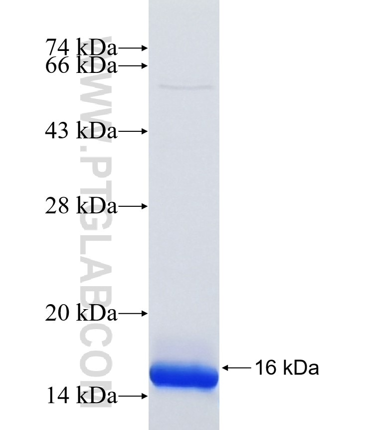 RNASET2 fusion protein Ag36625 SDS-PAGE
