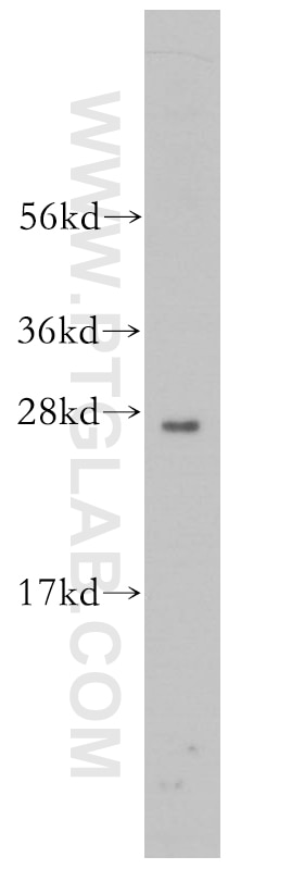 Western Blot (WB) analysis of mouse uterus tissue using RND2 Polyclonal antibody (13844-1-AP)