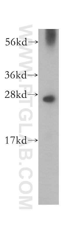 Western Blot (WB) analysis of PC-3 cells using RND2 Polyclonal antibody (13844-1-AP)