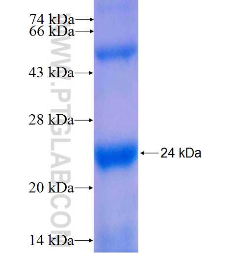 RND2 fusion protein Ag4972 SDS-PAGE
