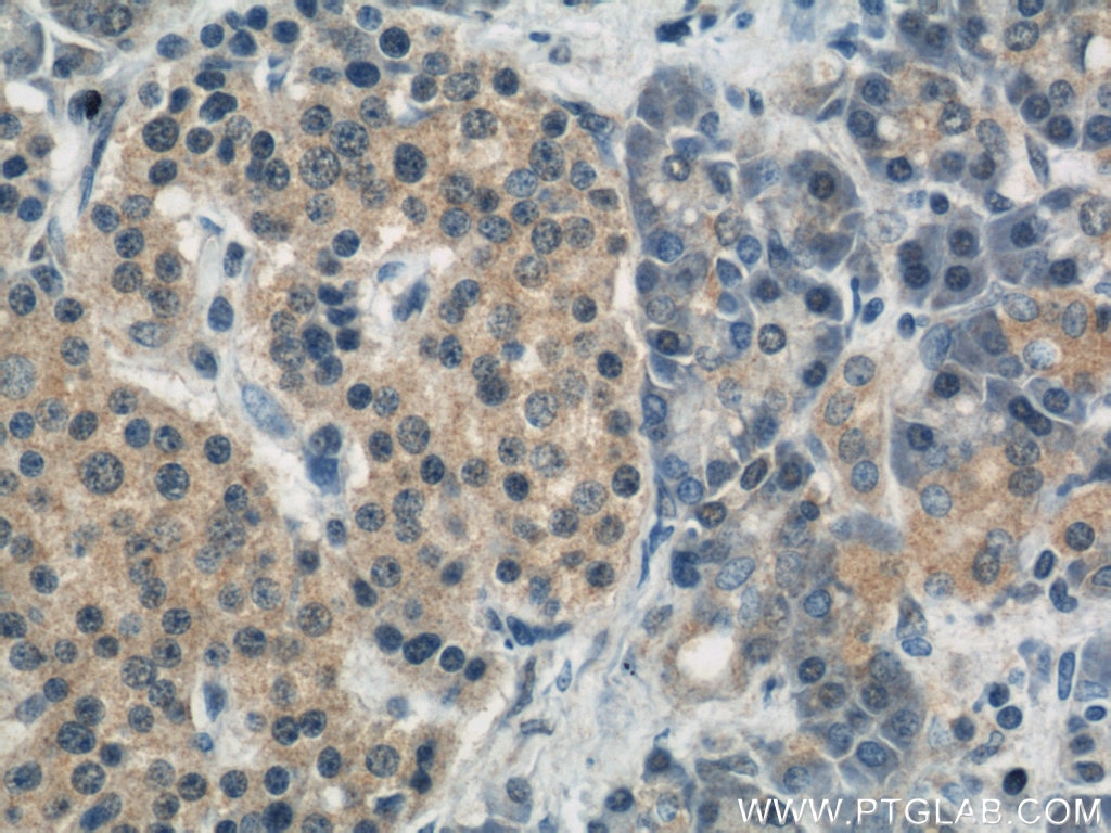 Immunohistochemistry (IHC) staining of human pancreas tissue using RND3 Polyclonal antibody (12534-1-AP)