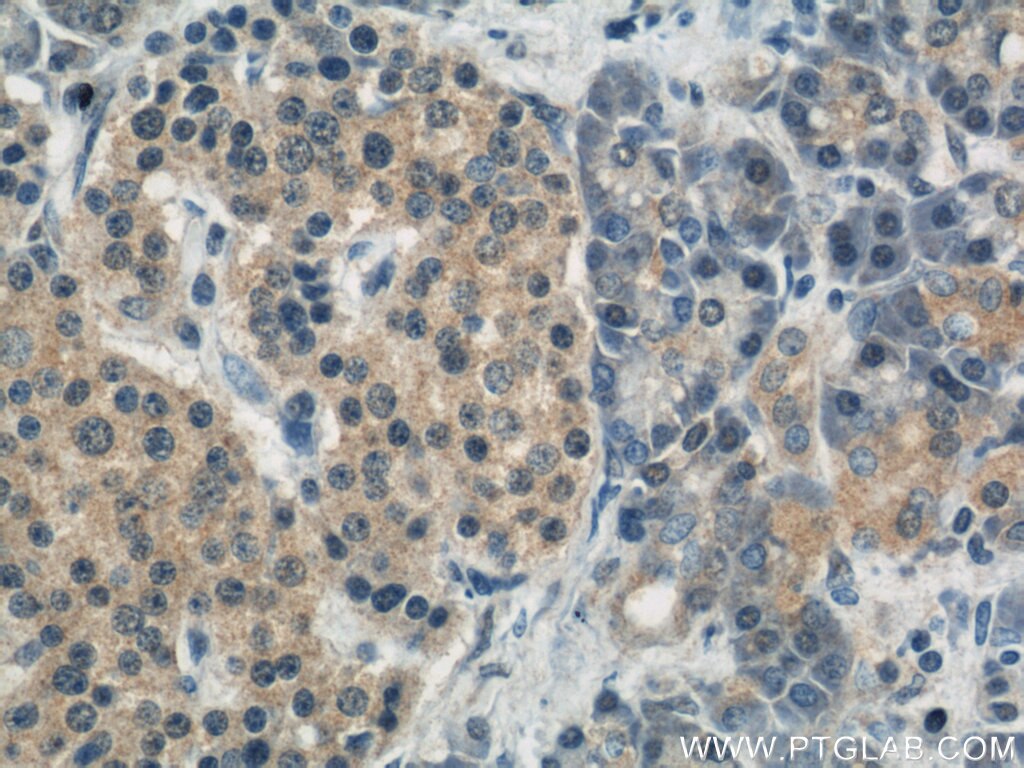 IHC staining of human pancreas using 12534-1-AP