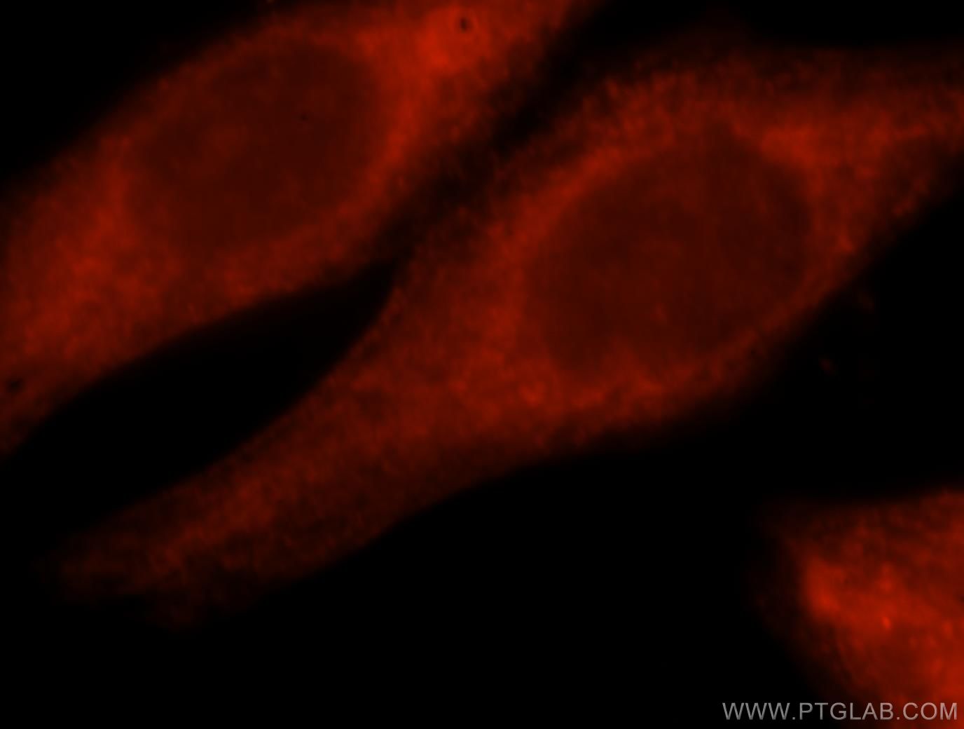 Immunofluorescence (IF) / fluorescent staining of HepG2 cells using RNF10 Polyclonal antibody (16936-1-AP)