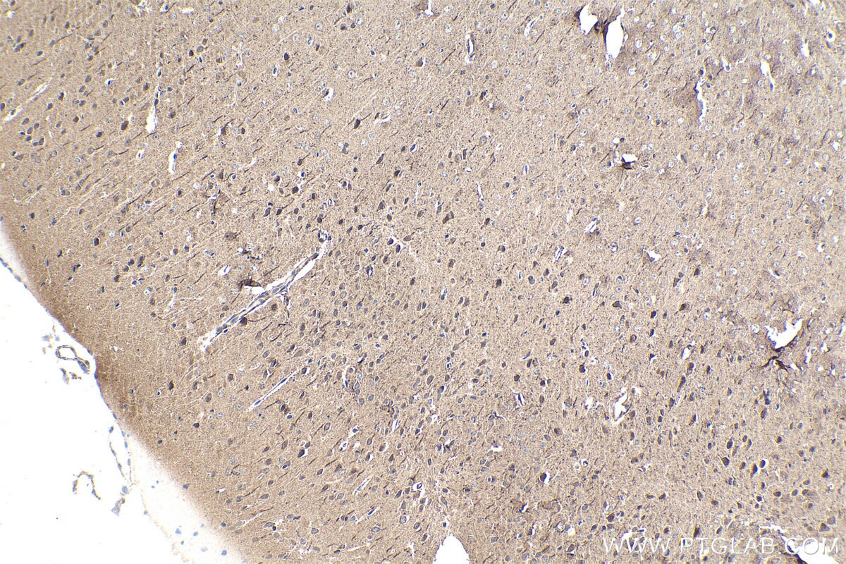 Immunohistochemistry (IHC) staining of mouse brain tissue using RNF10 Polyclonal antibody (16936-1-AP)