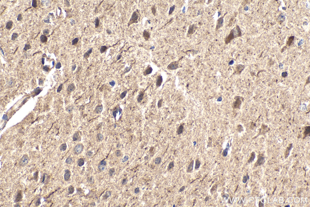 Immunohistochemistry (IHC) staining of mouse brain tissue using RNF10 Polyclonal antibody (16936-1-AP)