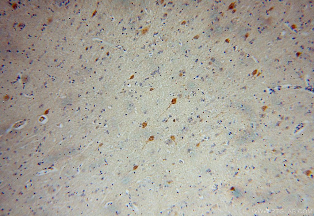 Immunohistochemistry (IHC) staining of human brain tissue using RNF10 Polyclonal antibody (16936-1-AP)