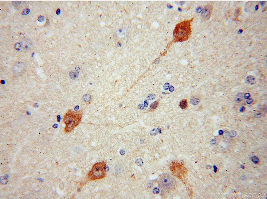 Immunohistochemistry (IHC) staining of human brain tissue using RNF10 Polyclonal antibody (16936-1-AP)