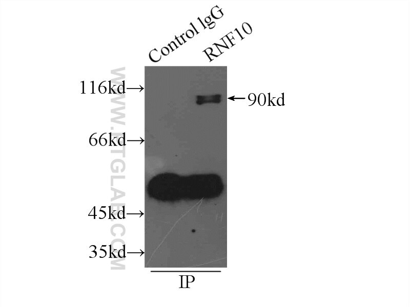 Immunoprecipitation (IP) experiment of PC-3 cells using RNF10 Polyclonal antibody (16936-1-AP)