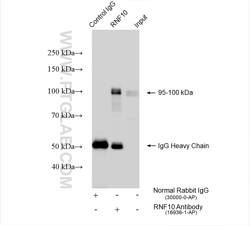 Immunoprecipitation (IP) experiment of PC-3 cells using RNF10 Polyclonal antibody (16936-1-AP)