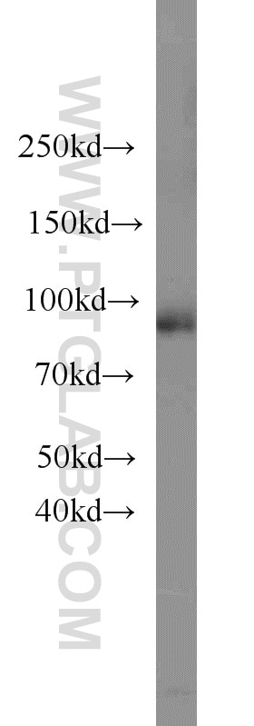 Western Blot (WB) analysis of Jurkat cells using RNF10 Polyclonal antibody (16936-1-AP)