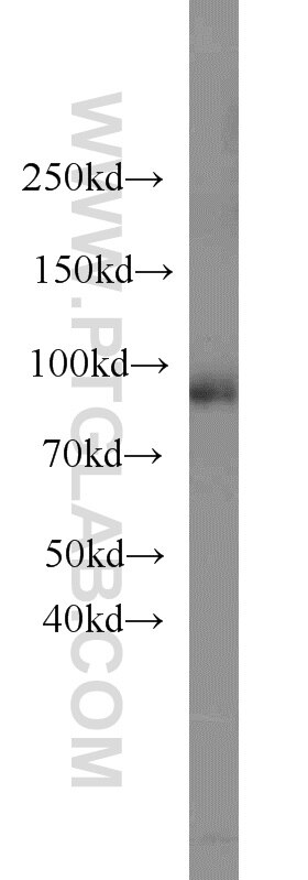 WB analysis of Jurkat using 16936-1-AP