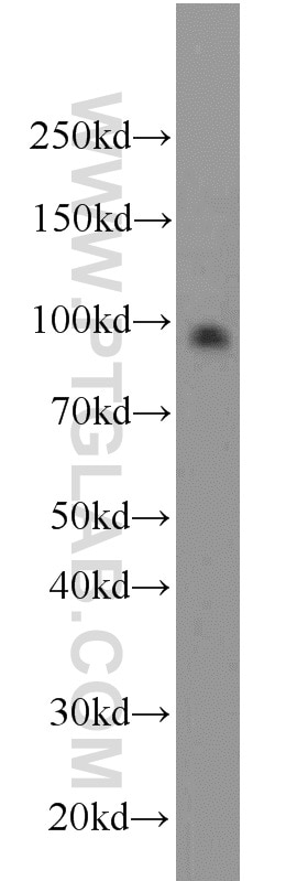 Western Blot (WB) analysis of PC-3 cells using RNF10 Polyclonal antibody (16936-1-AP)