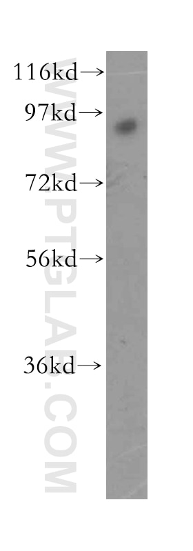 Western Blot (WB) analysis of human brain tissue using RNF10 Polyclonal antibody (16936-1-AP)