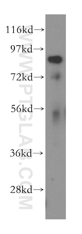 Western Blot (WB) analysis of human brain tissue using RNF10 Polyclonal antibody (16936-1-AP)